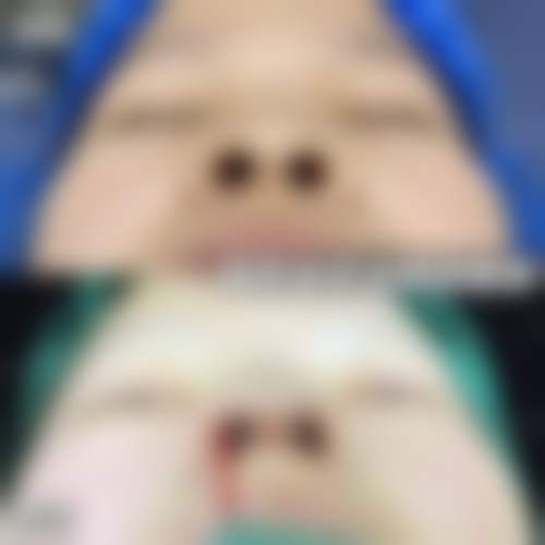 【安徽合肥白领安琪儿整形是正规的吗?】