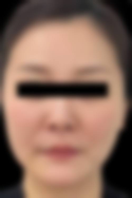 【陈玉叶医生擅长项目】
