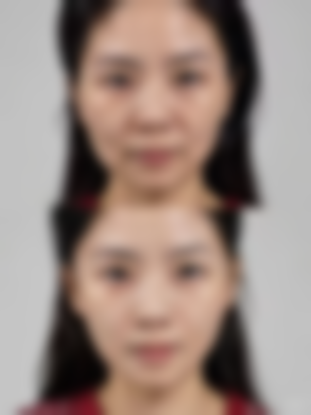【北京禾悦医疗美容诊所患者口碑评价：】