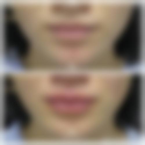 【北京悦美好医医疗美容诊所是正规的吗?】