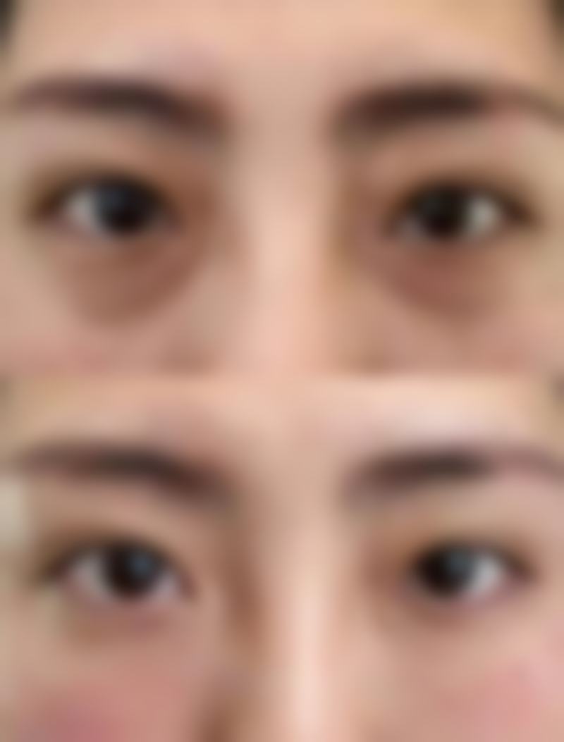 瘦脸针哪里打比较正规