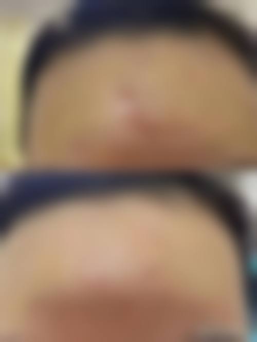 【刘其成医生技术特点:】