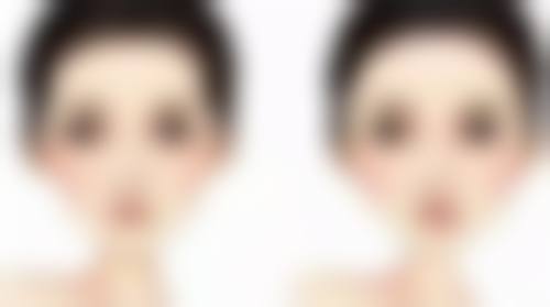 下巴整形有风险吗