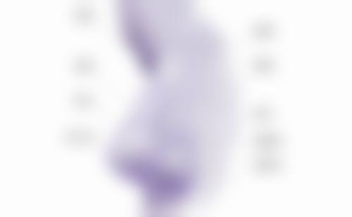 脂肪填充15天修复照片