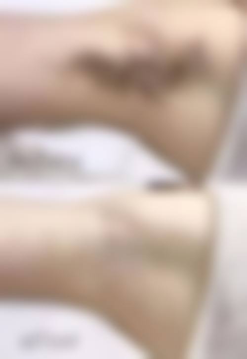 【寇晨程医生技术特点:】