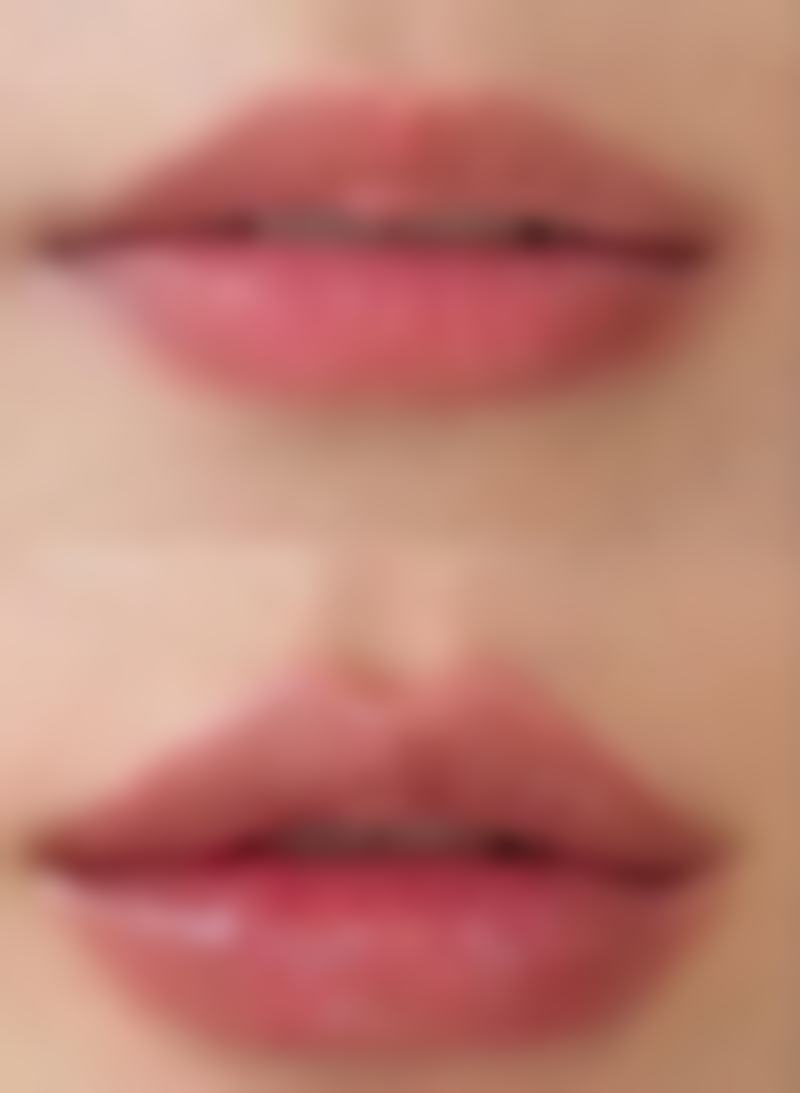 【庄贺婷医生技术特点】