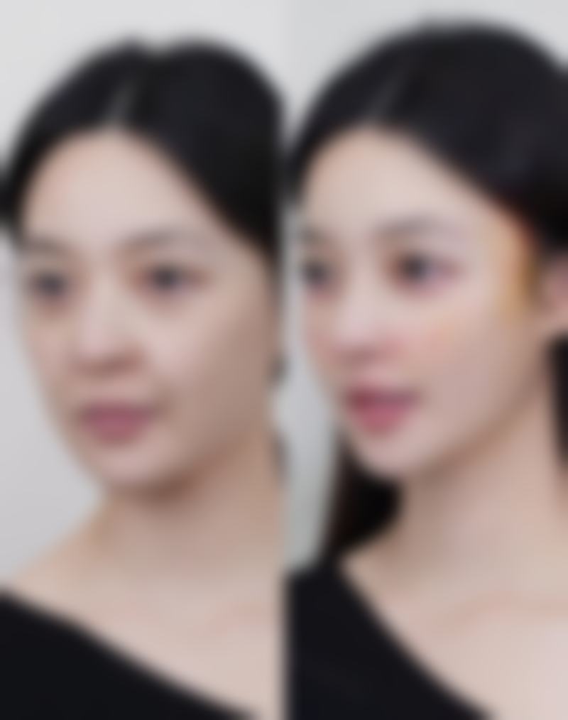 【无锡美连堂医疗美容诊所患者口碑评价:】