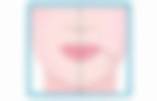 打完瘦脸针8天了感觉脸还是肿的