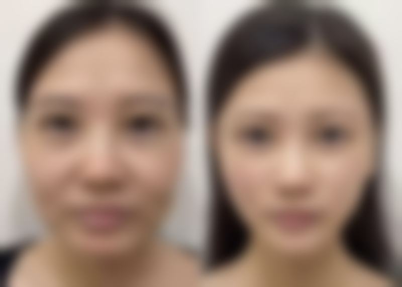 哪个医院打美白针好？揭秘3家口碑医美医院，专业技术保障，让你安全拥有白皙美肌！ 