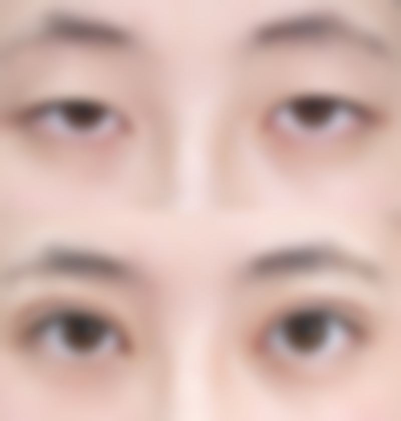 正规医院打美白针挂什么科