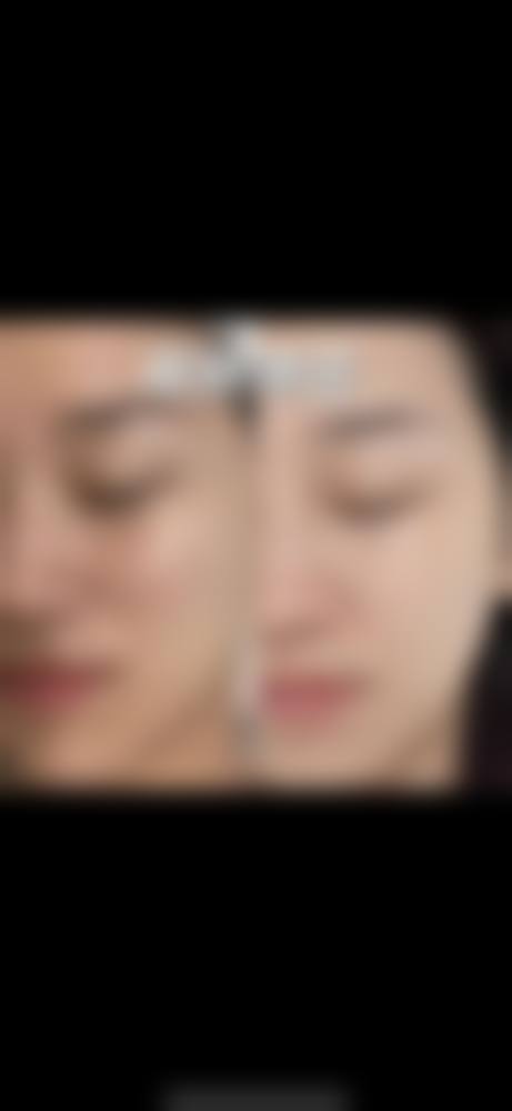 【西宁懿嘉医疗美容诊所参考价格表:】
