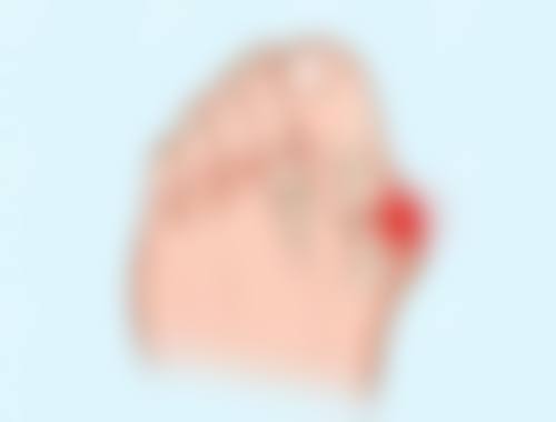 如何选择合适的瘦脸针治疗