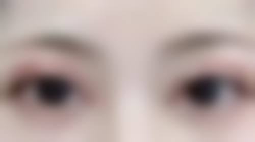 包皮过短能修复吗