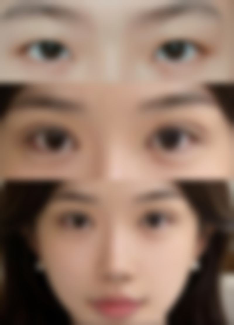 【宁波慈溪悦尔整形医院是正规的吗?】