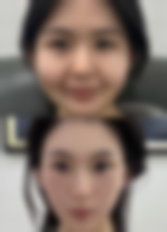 包皮短影响生育吗