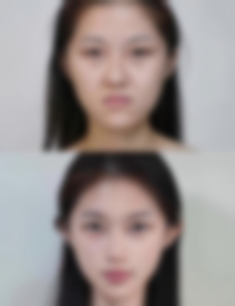 微笑唇方法