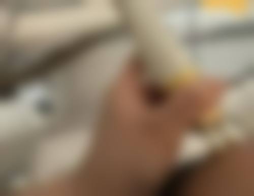 青少年嘴唇厚怎么变薄