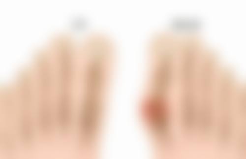 什么脸适合打瘦脸针？精准解读3类适配脸型，教你打造自然小V脸，轻松拥有明星同款精致轮廓！ 