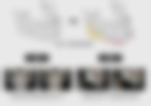 什么人适合打瘦脸针
