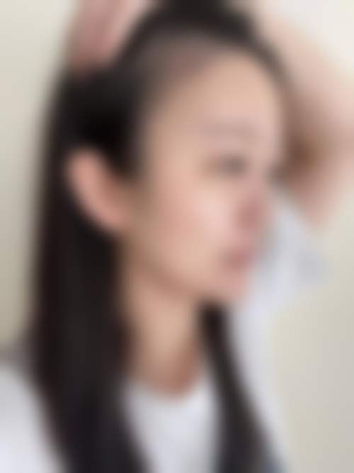 扬州俏华美医疗美容诊所高军飞做吸脂手术值不值?