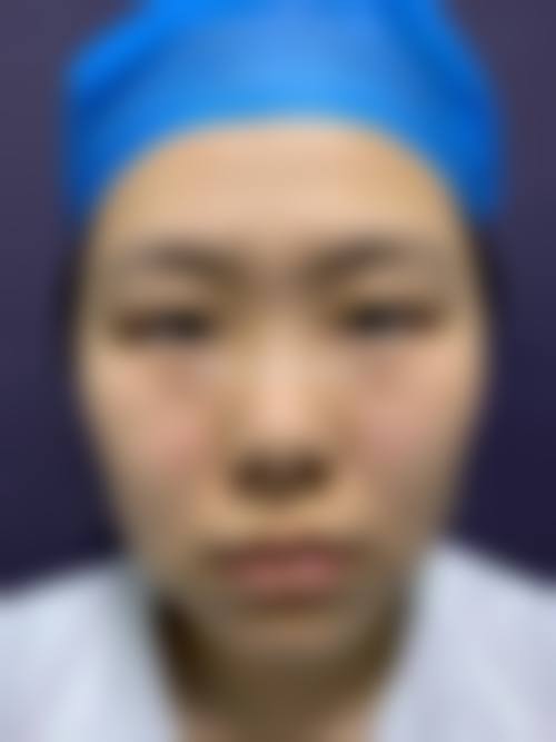武汉斯启诺医疗美容门诊部刘敏先做眼部和鼻部整形有什么优势