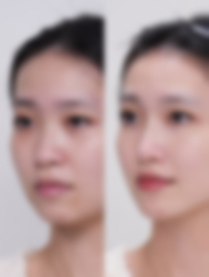 嘴凸真的不好看吗?