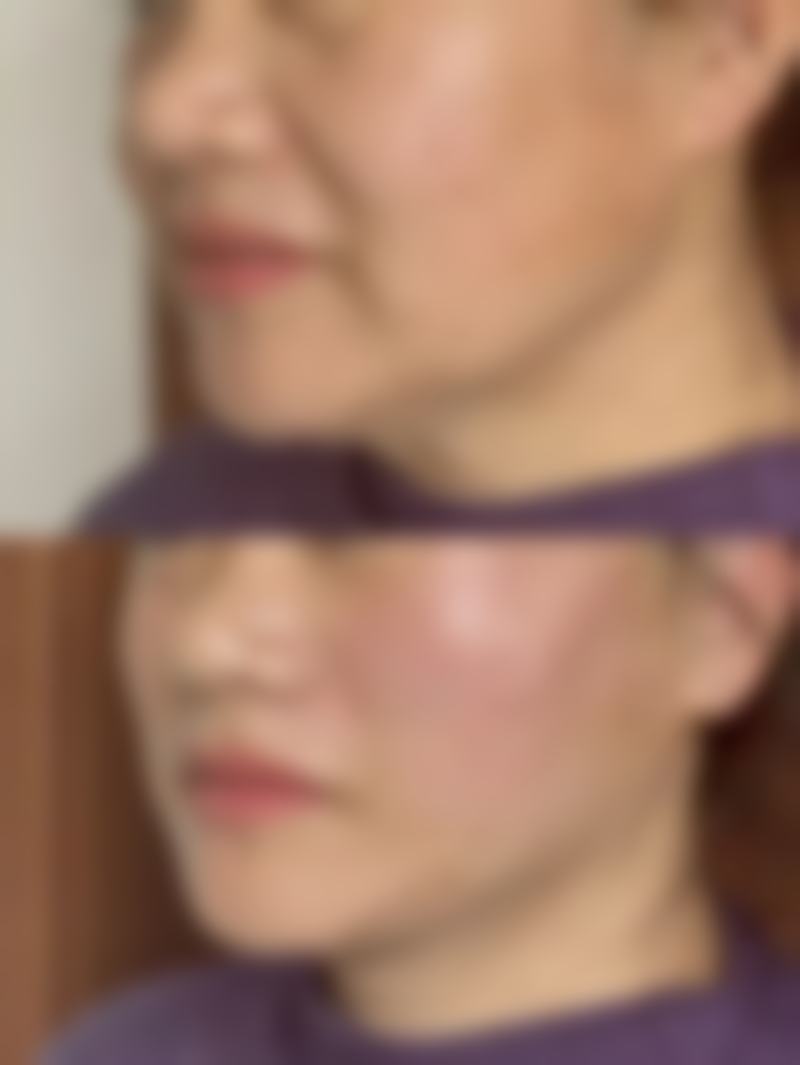 嘴凸能自我修复么?