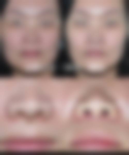 【广州环尹整形门诊部怎么预约挂号?】