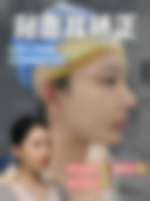 【余干县优嘉整形医院特色项目:】