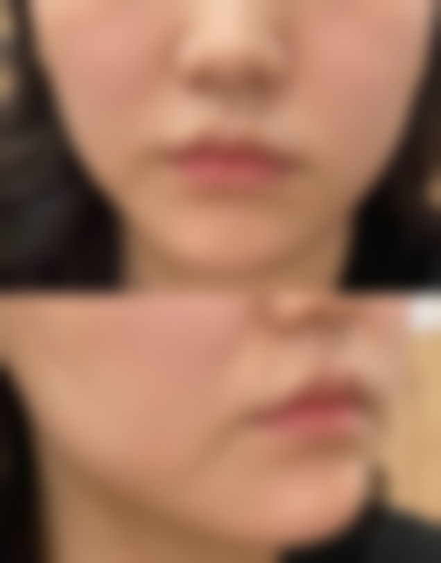 【合肥蜀山翡睿医疗美容门诊部是正规的吗?】