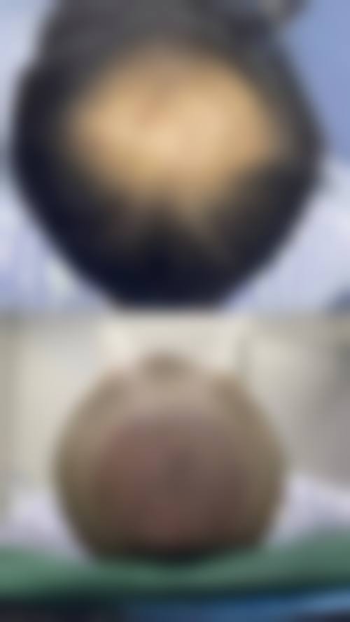 【武汉瑞丽诗植发医院怎么预约挂号?】