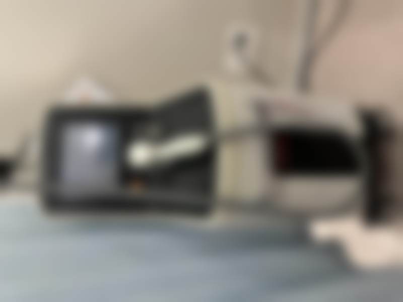 韩国S女性医院李惠妍做私密激光值不值