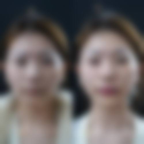 【韩国ME&YOU整形外科特色项目：】