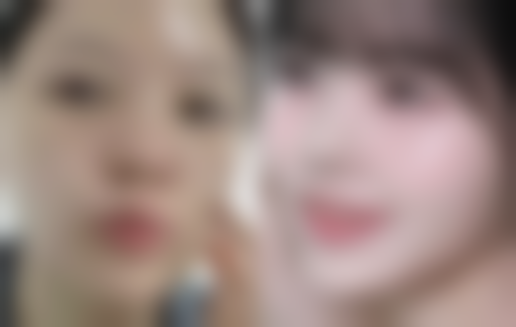 【韩国ME&YOU整形外科诊疗设备：】