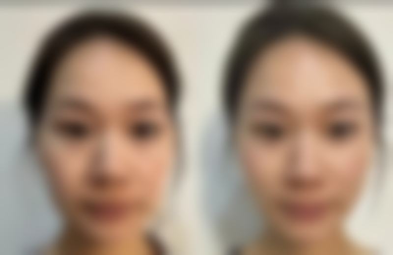 【心斎桥Komuro美容外科怎么预约挂号?】