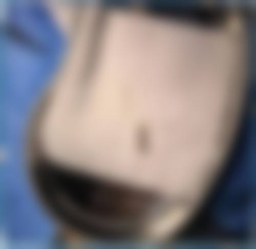 【淮北天香整形医院核心优势：】