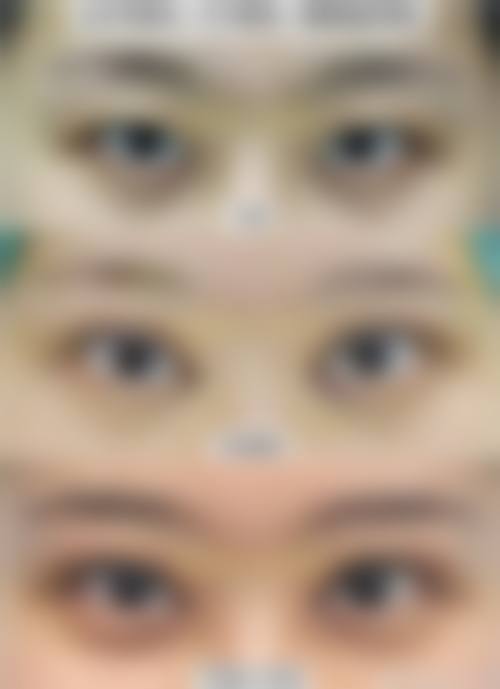 擅长项目详解：刘贤硕医生擅长的项目适合我吗？