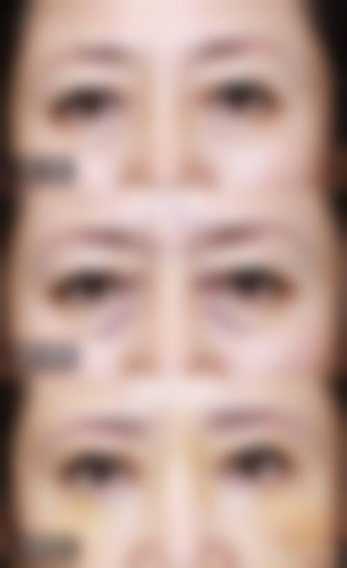 FAQ：常见问题解答