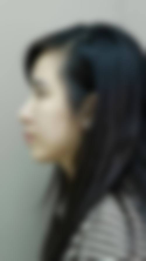 临床实例分享
