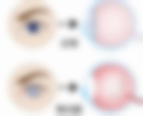 临床实例分享