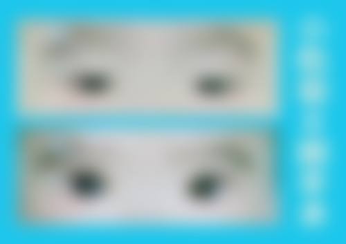 总结与展望：专精眼科守护清晰视界