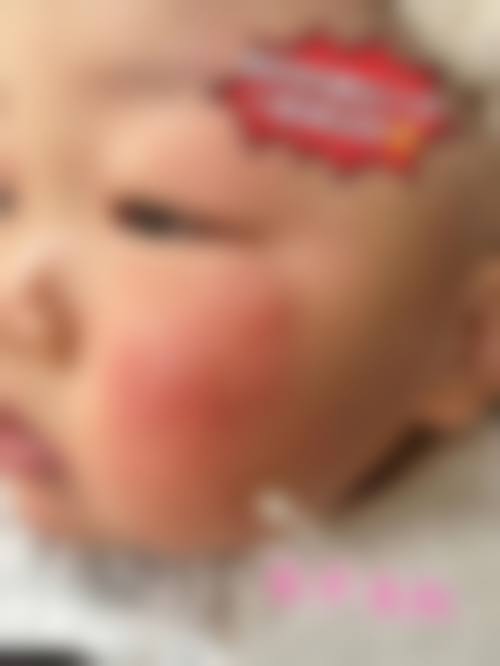 患者真实评价：湘西土家族苗族自治州人民医院眼科龙云峰