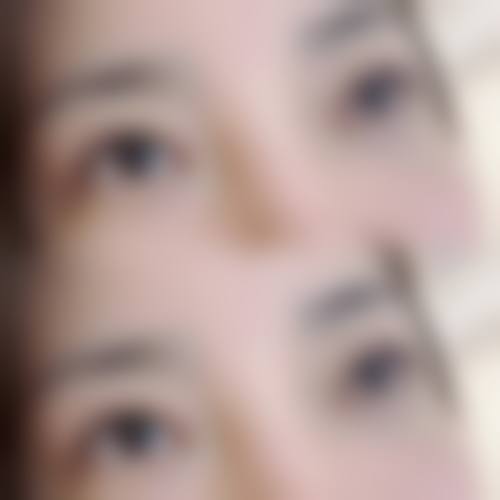 临床实例分享