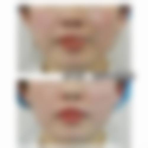擅长项目详解