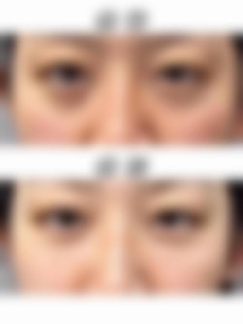总结与预约号召